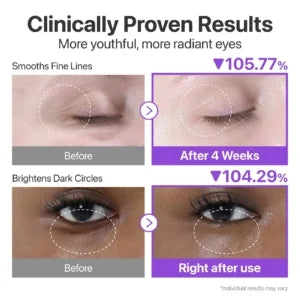 Numbuzin No.9 Eye Cream + Celimax Retinal Shot – Anti-Aging &amp; Firming Duo