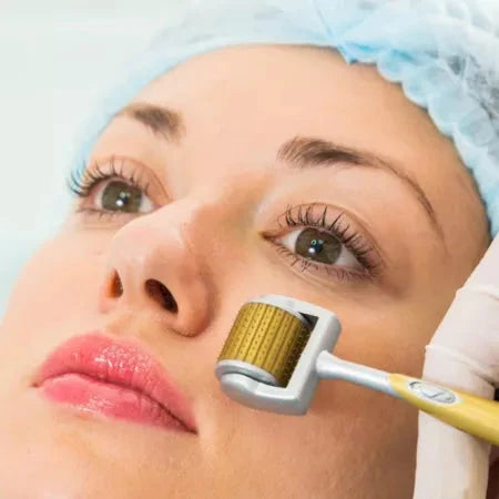 ZGTS Derma Roller Professional Gold Titanium Rose Cosmetics