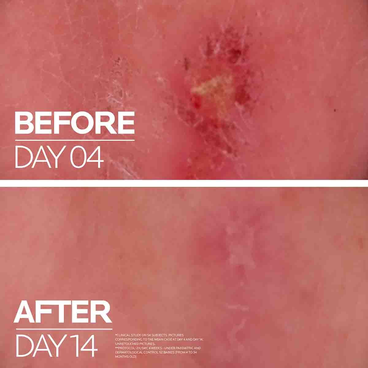 La Roche Protection & Repair Duo Rose Cosmetics