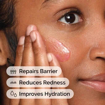 The Ordinary Soothing & Barrier Support Serum Rose Cosmetics